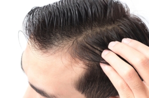 Regelmäßige PRP Behandlungen erhalten volles und kräftiges Haar